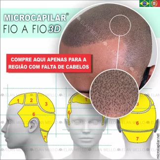 COMPRAR POR REGIÃO - MICROCAPILAR 3D® FIO A FIO