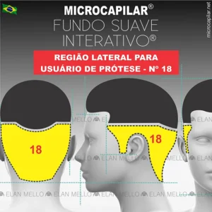 Microcapilar® Indicada Para Restaurar a Lateral de Usuários de Prótese Capilar