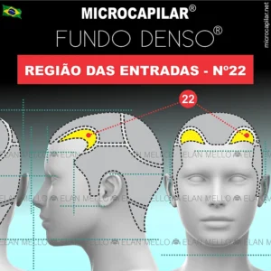 Microcapilar® Fundo Denso® na Região das Entradas - n.º 22