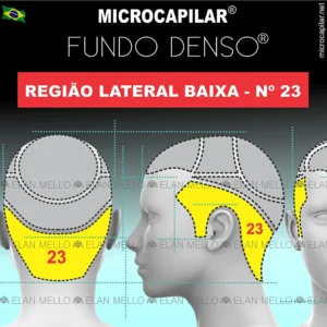 Microcapilar® Fundo Denso® na Região Lateral Baixa – n.º 23