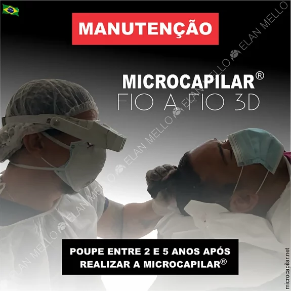 <b>Manutenção de Microcapilar 3D® Fio a fio</b> -  Com desconto de 2 a 5 anos