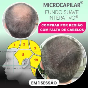COMPRAR POR REGIÃO - MICROCAPILAR 3D® FUNDO SUAVE INTERATIVO®