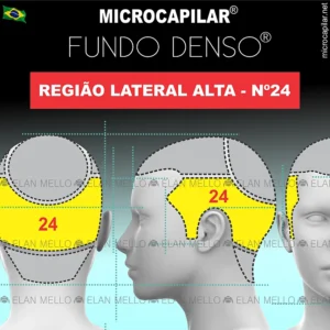 Microcapilar® Fundo Denso® na Região Lateral Alta #24