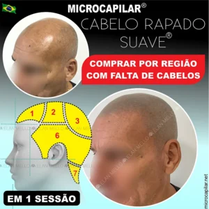 COMPRAR POR REGIÃO – EFEITO RAPADO SUAVE® – MICROCAPILAR®
