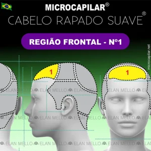 Microcapilar® Cabelo Rapado Suave® na Região Frontal #1