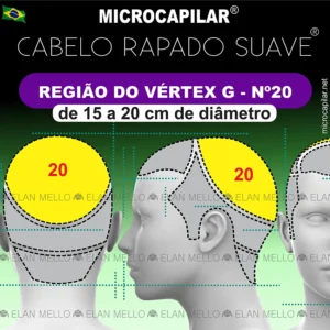 Microcapilar® Cabelo Rapado Suave® na Região do Vértex / Coroa - G - n.º 20